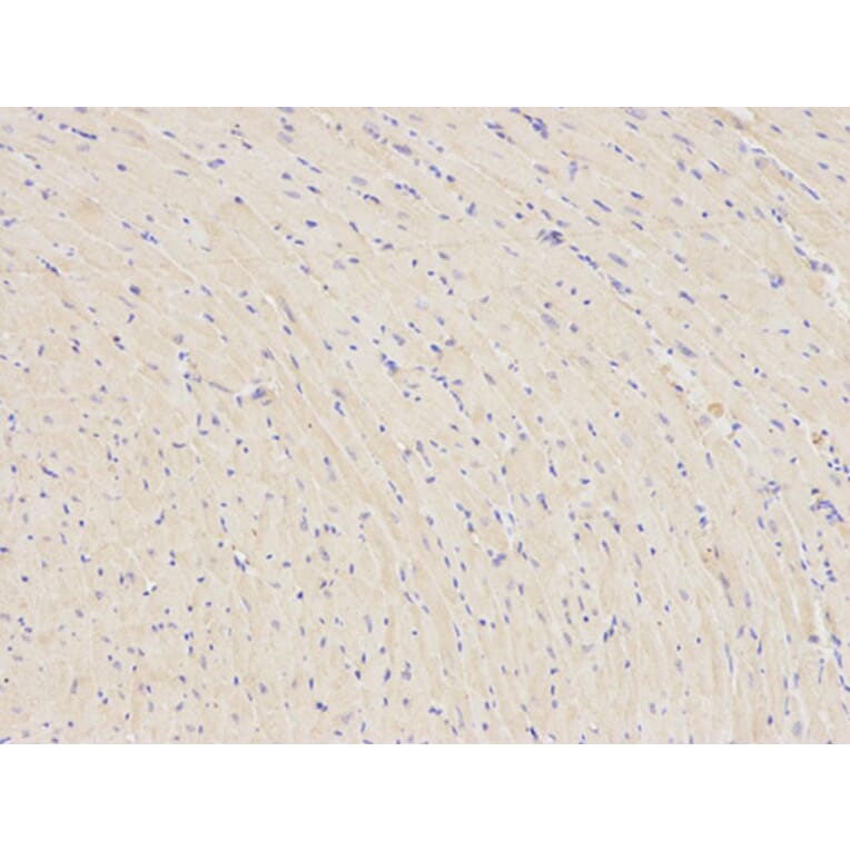 Immunohistochemistry - PARK2 Antibody from Signalway Antibody (32097) - Antibodies.com