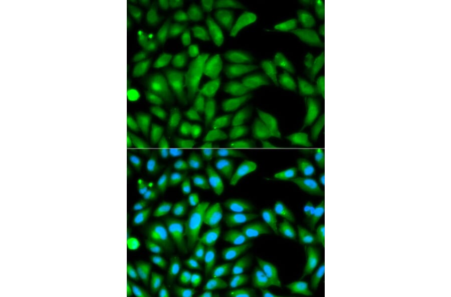 Immunofluorescence - PARK2 Antibody from Signalway Antibody (32097) - Antibodies.com