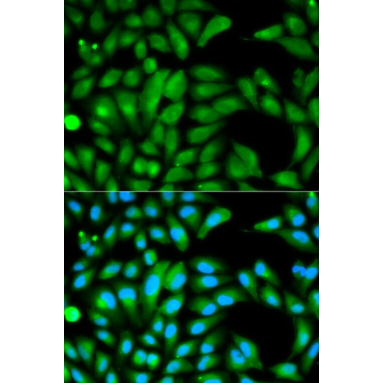 Immunofluorescence - PARK2 Antibody from Signalway Antibody (32097) - Antibodies.com