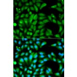 Immunofluorescence - PARK2 Antibody from Signalway Antibody (32097) - Antibodies.com