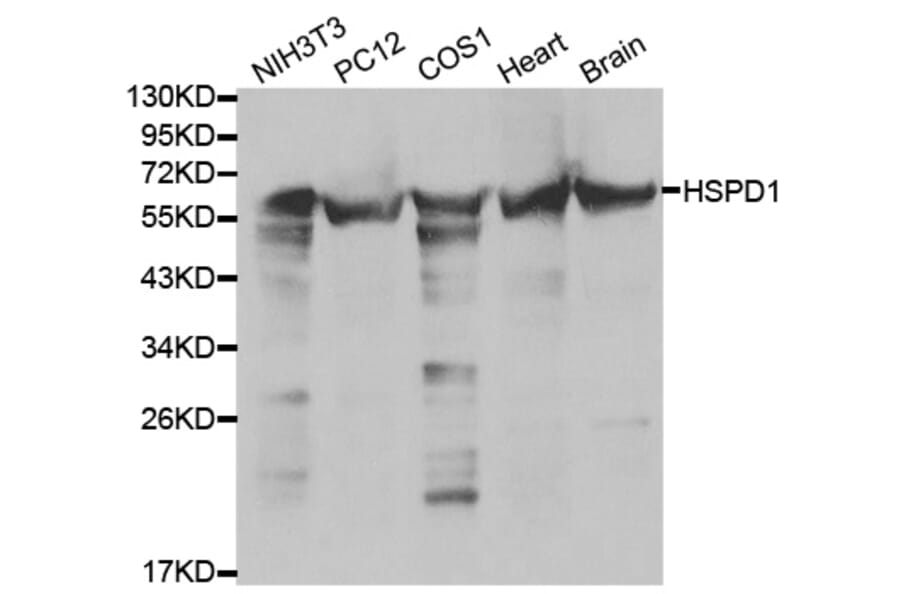 Western blot - HSPD1 Antibody from Signalway Antibody (32098) - Antibodies.com
