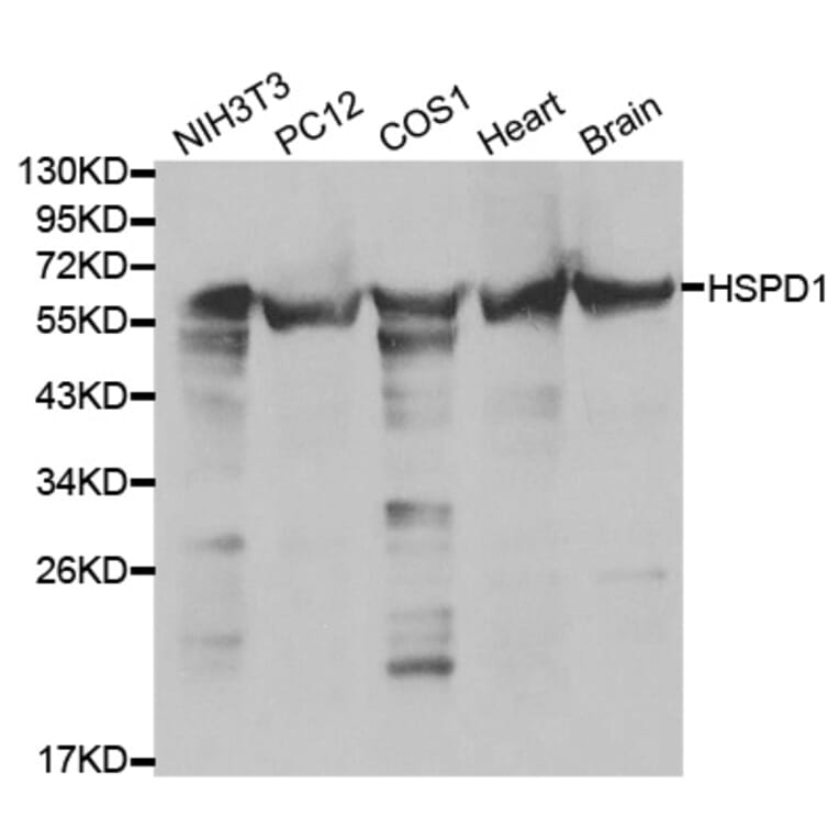 Western blot - HSPD1 Antibody from Signalway Antibody (32098) - Antibodies.com