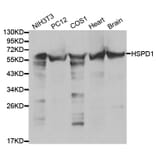 Western blot - HSPD1 Antibody from Signalway Antibody (32098) - Antibodies.com