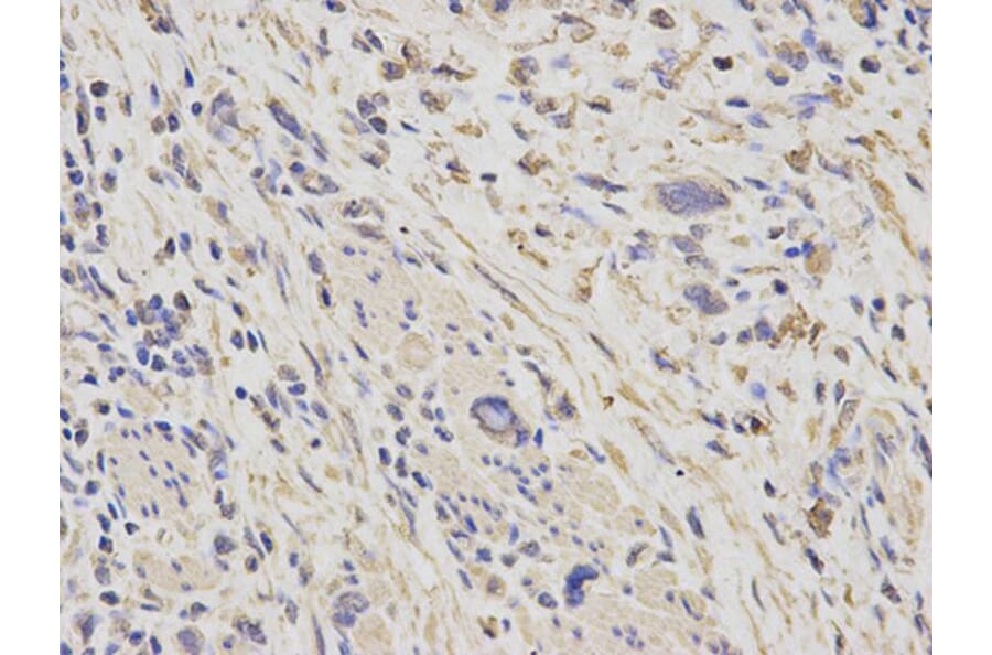 Immunohistochemistry - HSPD1 Antibody from Signalway Antibody (32098) - Antibodies.com