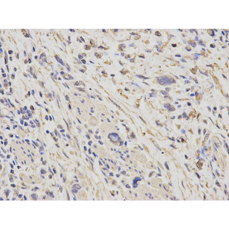 Immunohistochemistry - HSPD1 Antibody from Signalway Antibody (32098) - Antibodies.com