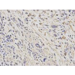 Immunohistochemistry - HSPD1 Antibody from Signalway Antibody (32098) - Antibodies.com
