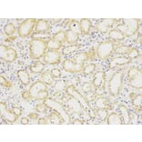 Immunohistochemistry - SIRT7 Antibody from Signalway Antibody (32106) - Antibodies.com