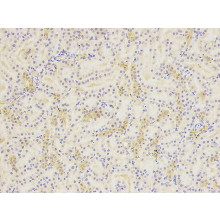 Immunohistochemistry - SIRT7 Antibody from Signalway Antibody (32106) - Antibodies.com