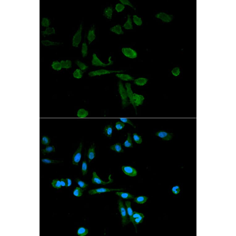 Immunofluorescence - SIRT7 Antibody from Signalway Antibody (32106) - Antibodies.com