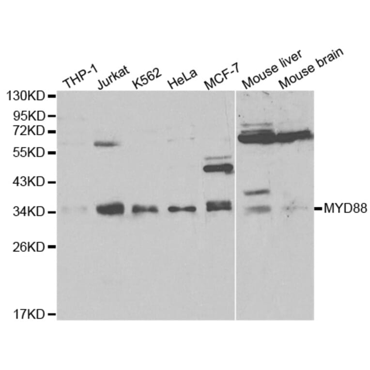 Western blot - MyD88 Antibody from Signalway Antibody (32107) - Antibodies.com