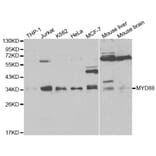 Western blot - MyD88 Antibody from Signalway Antibody (32107) - Antibodies.com