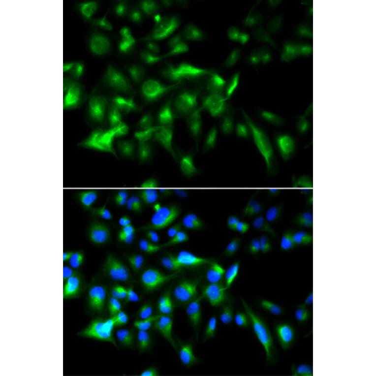 Immunofluorescence - MyD88 Antibody from Signalway Antibody (32107) - Antibodies.com