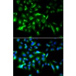 Immunofluorescence - MyD88 Antibody from Signalway Antibody (32107) - Antibodies.com