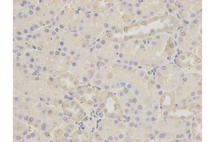Immunohistochemistry - BIRC2 Antibody from Signalway Antibody (32110) - Antibodies.com