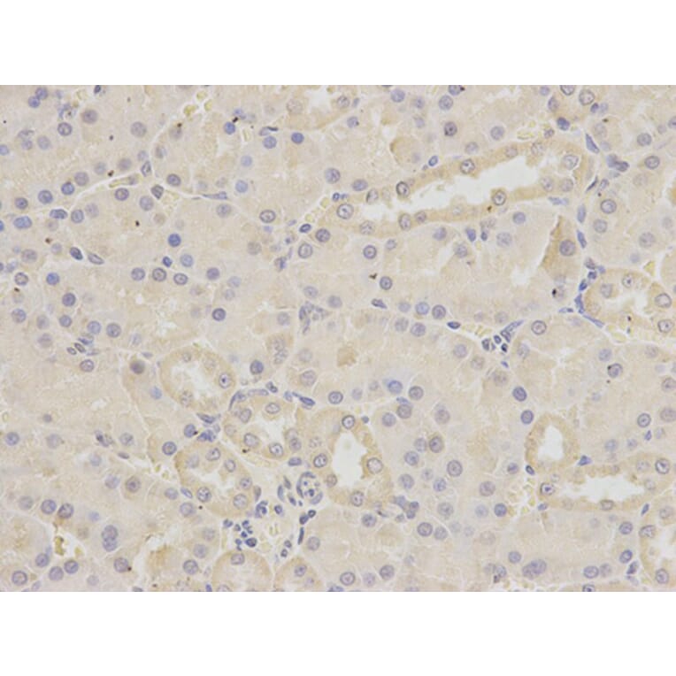 Immunohistochemistry - BIRC2 Antibody from Signalway Antibody (32110) - Antibodies.com
