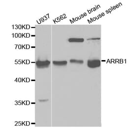 Western blot - ARRB1 Antibody from Signalway Antibody (32118) - Antibodies.com