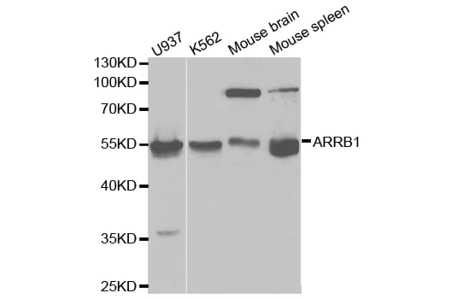 Western blot - ARRB1 Antibody from Signalway Antibody (32118) - Antibodies.com