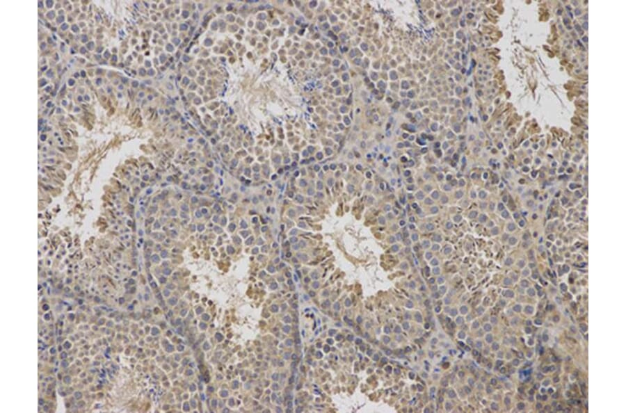 Immunohistochemistry - ARRB1 Antibody from Signalway Antibody (32118) - Antibodies.com