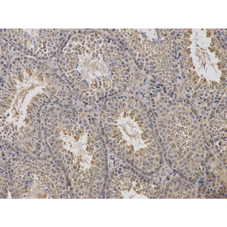 Immunohistochemistry - ARRB1 Antibody from Signalway Antibody (32118) - Antibodies.com