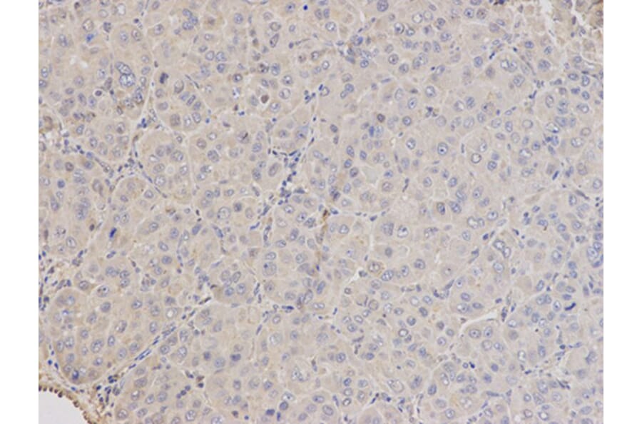 Immunohistochemistry - ARRB1 Antibody from Signalway Antibody (32118) - Antibodies.com