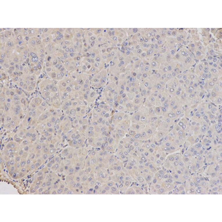 Immunohistochemistry - ARRB1 Antibody from Signalway Antibody (32118) - Antibodies.com