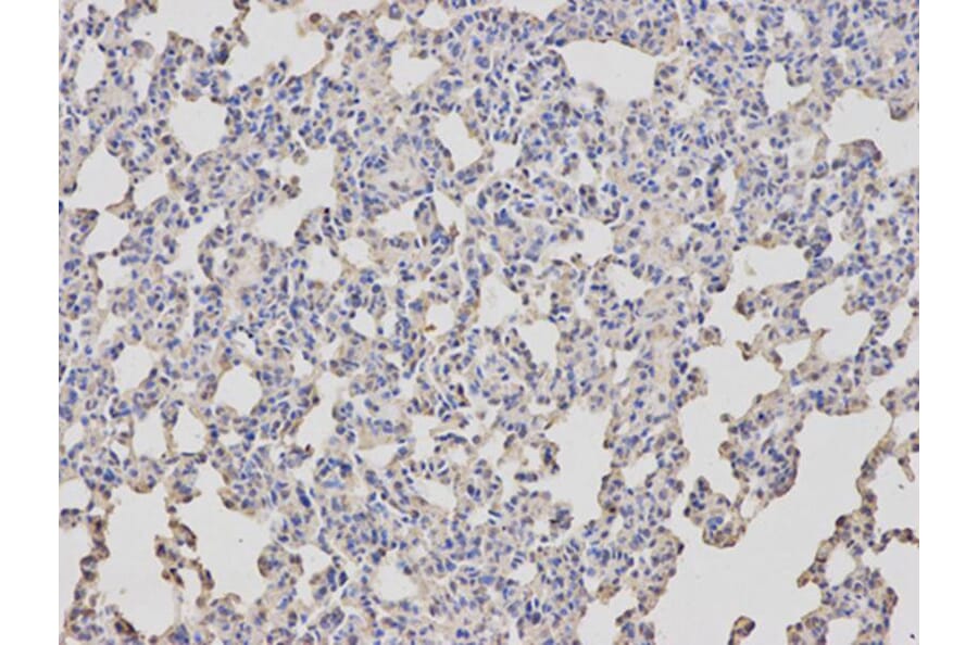 Immunohistochemistry - ARRB1 Antibody from Signalway Antibody (32118) - Antibodies.com