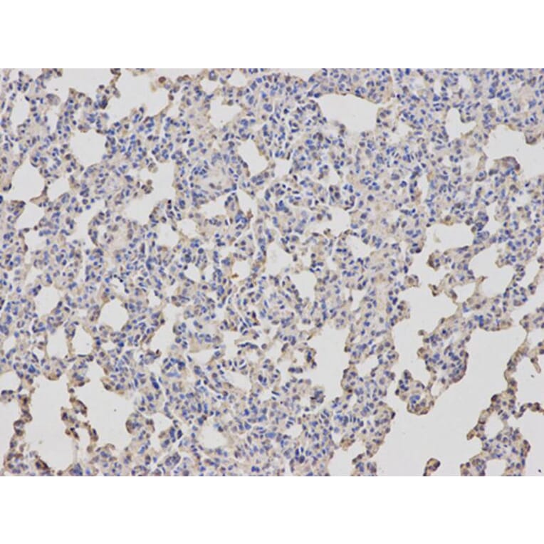 Immunohistochemistry - ARRB1 Antibody from Signalway Antibody (32118) - Antibodies.com