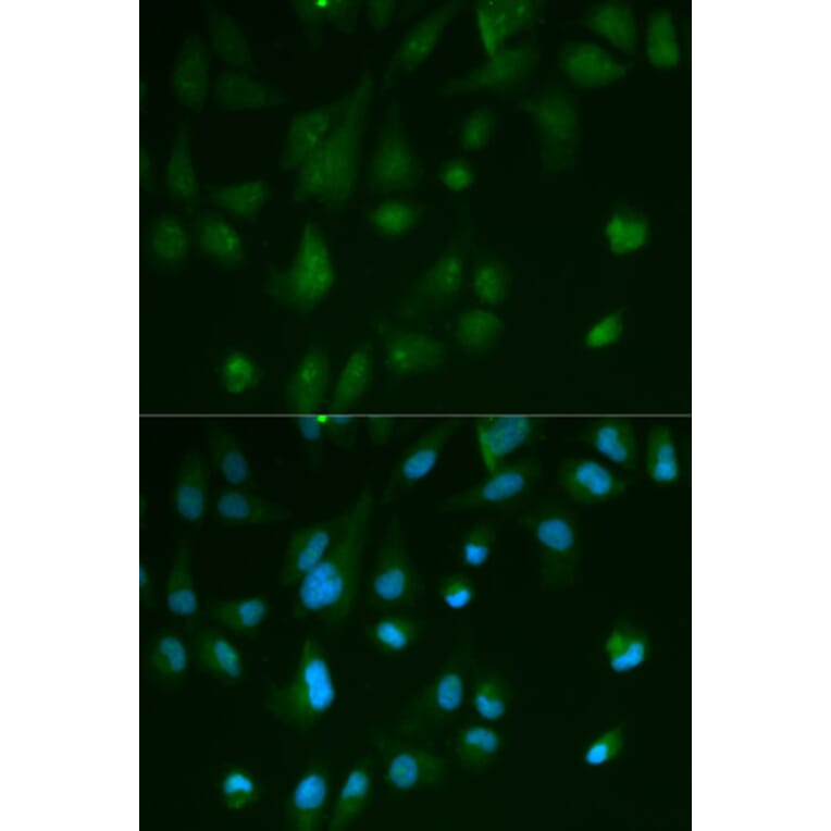 Immunofluorescence - ARRB1 Antibody from Signalway Antibody (32118) - Antibodies.com