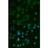 Immunofluorescence - ARRB1 Antibody from Signalway Antibody (32118) - Antibodies.com