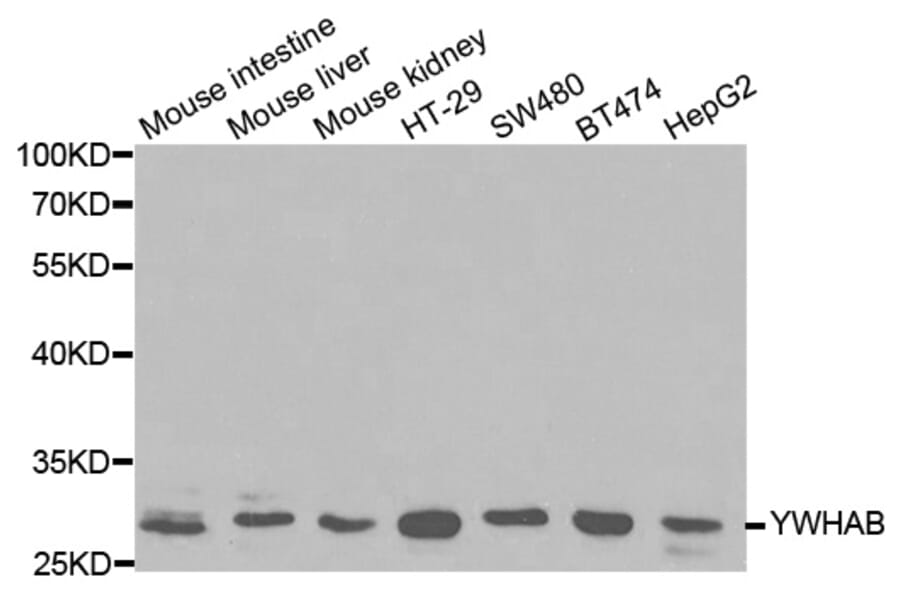 Western blot - YWHAB Antibody from Signalway Antibody (32123) - Antibodies.com