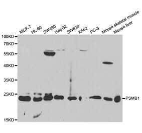 Western blot - PSMB1 Antibody from Signalway Antibody (32130) - Antibodies.com