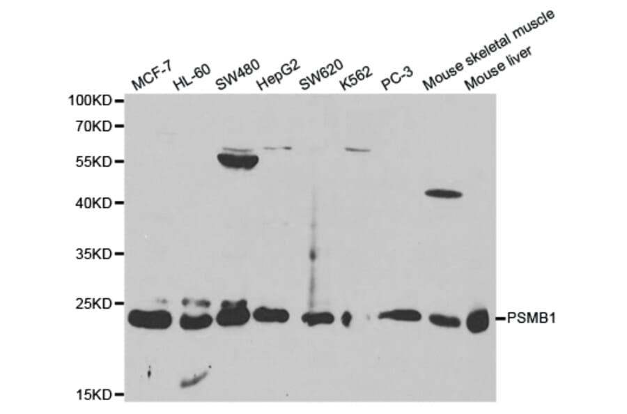 Western blot - PSMB1 Antibody from Signalway Antibody (32130) - Antibodies.com
