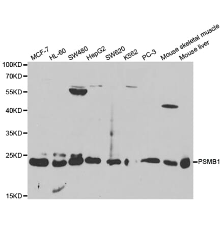 Western blot - PSMB1 Antibody from Signalway Antibody (32130) - Antibodies.com