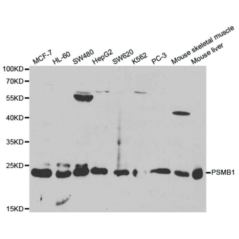 Western blot - PSMB1 Antibody from Signalway Antibody (32130) - Antibodies.com