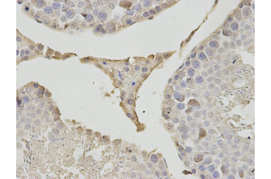 Immunohistochemistry - PSMB1 Antibody from Signalway Antibody (32130) - Antibodies.com