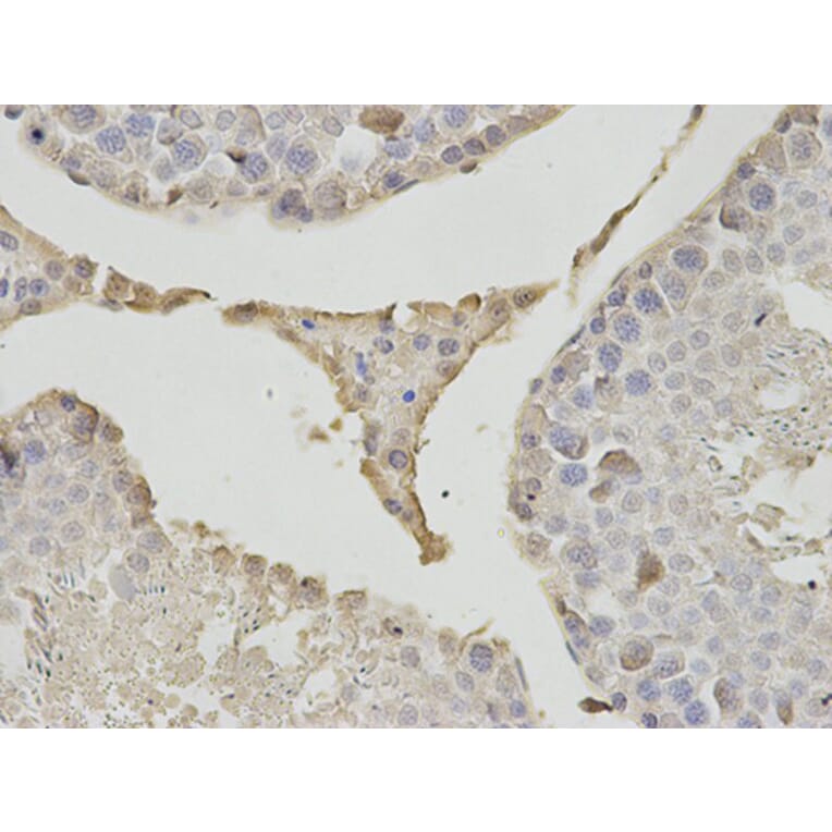 Immunohistochemistry - PSMB1 Antibody from Signalway Antibody (32130) - Antibodies.com