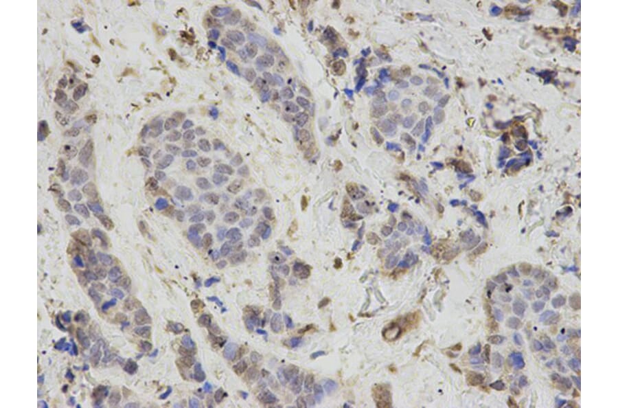 Immunohistochemistry - PSMB1 Antibody from Signalway Antibody (32130) - Antibodies.com