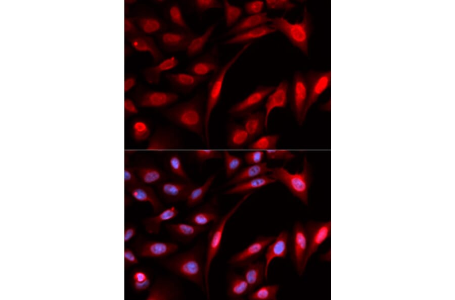 Immunofluorescence - PSMB1 Antibody from Signalway Antibody (32130) - Antibodies.com