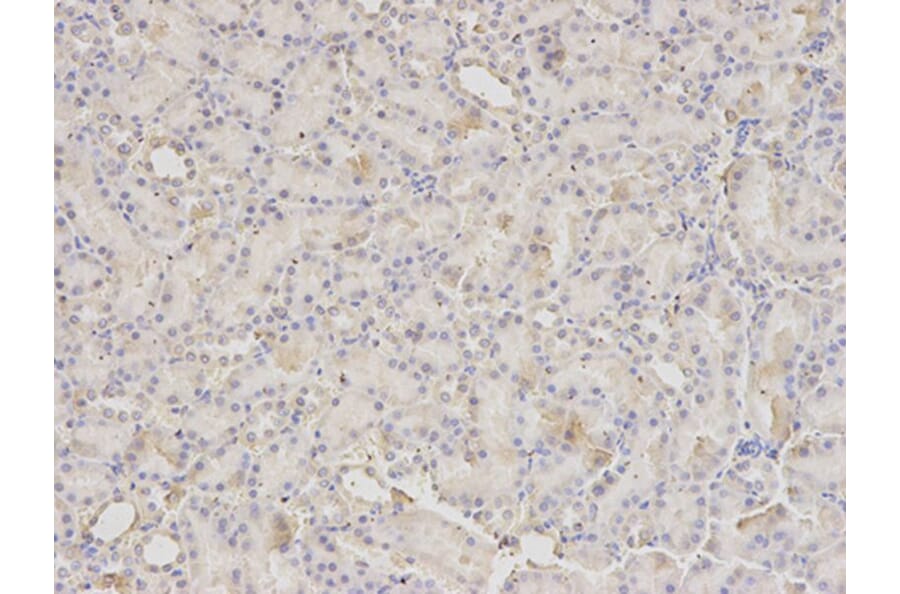 Immunohistochemistry - PDIA3 Antibody from Signalway Antibody (32150) - Antibodies.com