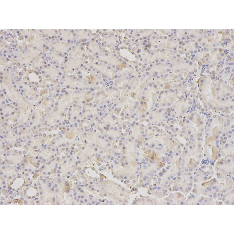 Immunohistochemistry - PDIA3 Antibody from Signalway Antibody (32150) - Antibodies.com