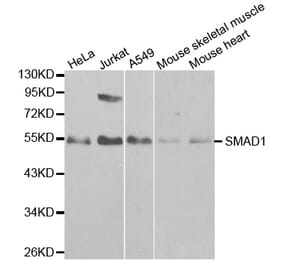 Western blot - SMAD1 Antibody from Signalway Antibody (32160) - Antibodies.com