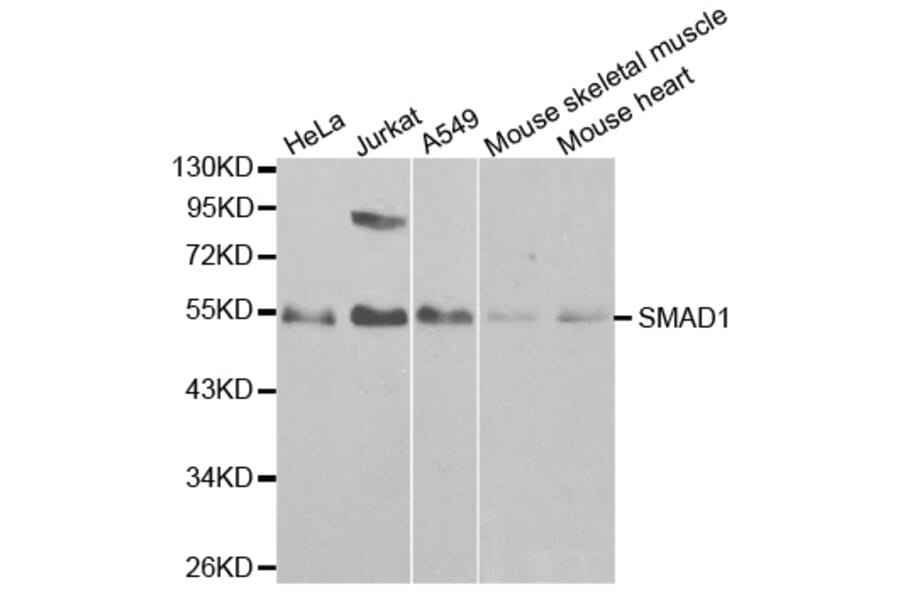 Western blot - SMAD1 Antibody from Signalway Antibody (32160) - Antibodies.com