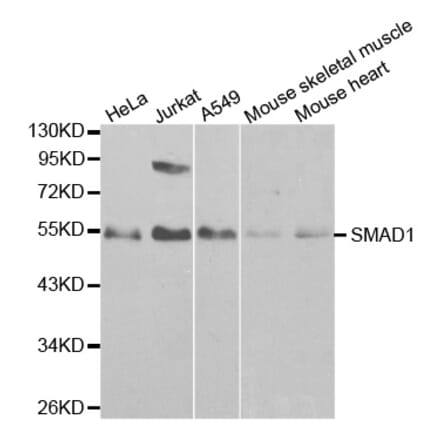 Western blot - SMAD1 Antibody from Signalway Antibody (32160) - Antibodies.com