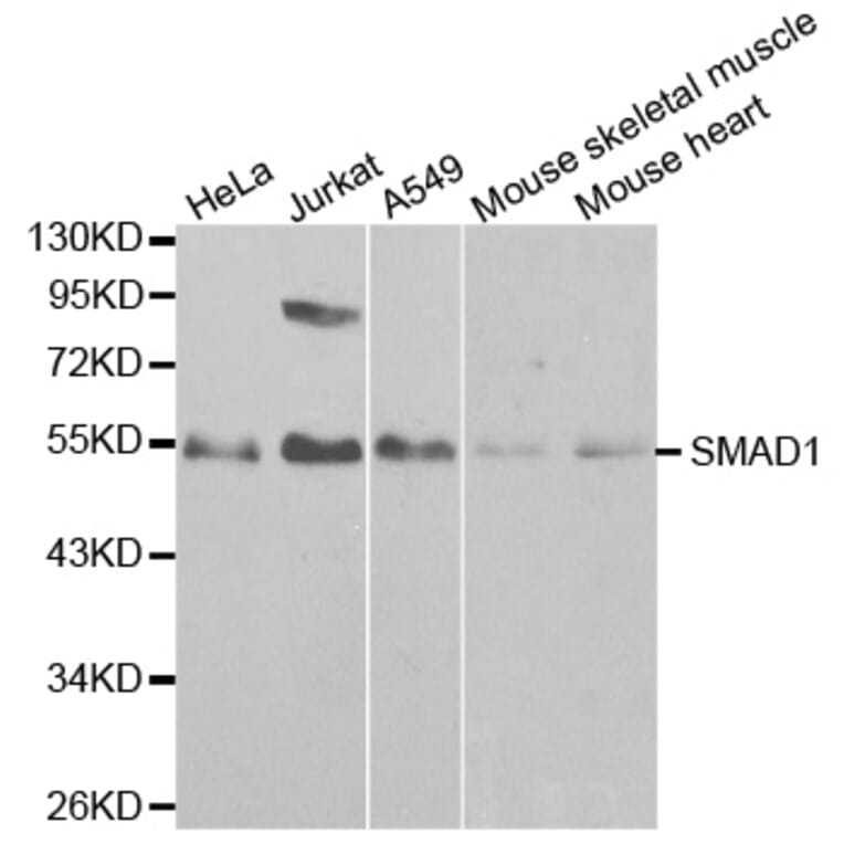 Western blot - SMAD1 Antibody from Signalway Antibody (32160) - Antibodies.com