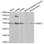Western blot - SMAD1 Antibody from Signalway Antibody (32160) - Antibodies.com