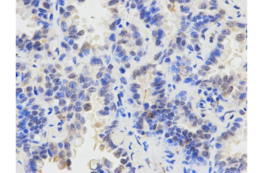 Immunohistochemistry - SMAD1 Antibody from Signalway Antibody (32160) - Antibodies.com