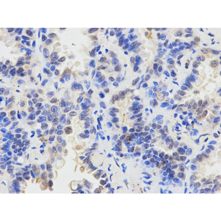 Immunohistochemistry - SMAD1 Antibody from Signalway Antibody (32160) - Antibodies.com