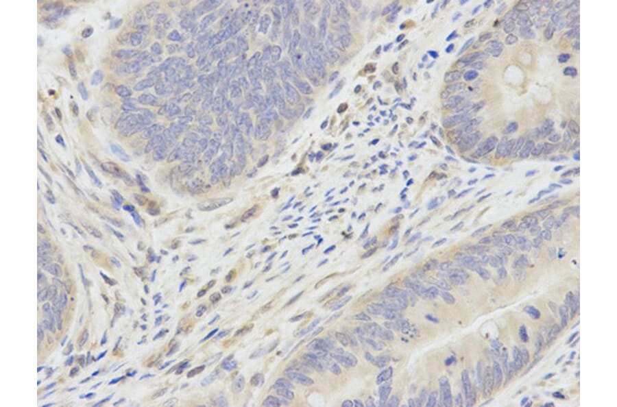 Immunohistochemistry - SMAD1 Antibody from Signalway Antibody (32160) - Antibodies.com