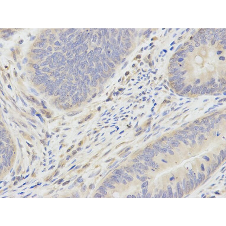 Immunohistochemistry - SMAD1 Antibody from Signalway Antibody (32160) - Antibodies.com