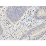 Immunohistochemistry - SMAD1 Antibody from Signalway Antibody (32160) - Antibodies.com